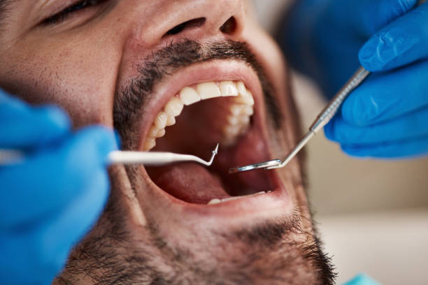 Oral Surgery in Tuscumbia, AL